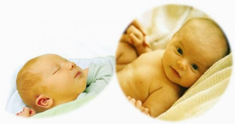 Bệnh vàng da ở trẻ sơ sinh là gì?